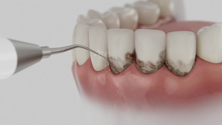 Trusted Dental Implants service in Fair Lakes, VA - Dentist Open Now